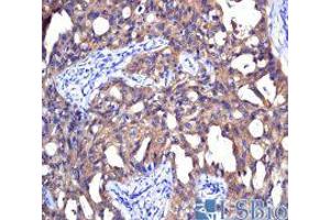 Immunohistochemistry (IHC) image for anti-Non-Metastatic Cells 1, Protein (NM23A) Expressed in (NME1) (N-Term) antibody (ABIN2792090)