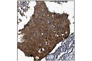 IHC analysis of KCNQ2 using anti-KCNQ2 antibody (ABIN7601522).
