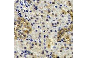 Immunohistochemical analysis of ST3GAL4 staining in rat kidney formalin fixed paraffin embedded tissue section. (ST3GAL4 抗体)