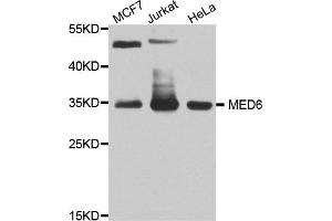 Western blot analysis of extracts of various cell lines, using MED6 antibody (ABIN5974801) at 1/1000 dilution. (MED6 抗体)