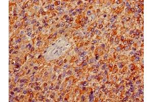 Immunohistochemistry (IHC) image for anti-Glial Fibrillary Acidic Protein (GFAP) (AA 292-432) antibody (ABIN7153847)