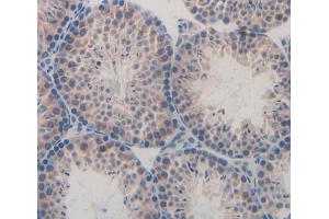 Used in DAB staining on fromalin fixed paraffin- embedded Kidney tissue (GNG8 抗体  (AA 1-70))