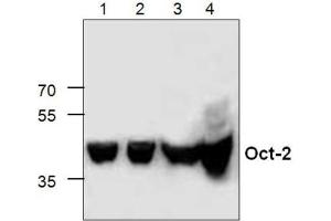 Western Blot analysis of Oct-2 expression in Lysates from Jukat cells (Lanes 1+2), 3T3 cells (Lane 3) and Rat Kidney (Lane 4). (Oct-2 抗体  (C-Term))