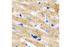 Immunohistochemical analysis of L2HGDH staining in mouse heart formalin fixed paraffin embedded tissue section. (L2HGDH 抗体)