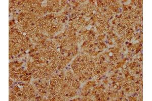 IHC image of ABIN7170757 diluted at 1:100 and staining in paraffin-embedded human adrenal gland tissue performed on a Leica BondTM system. (CYP21A2 抗体  (AA 312-418))