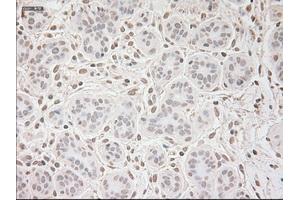 Immunohistochemical staining of paraffin-embedded breast tissue using anti-VEGF mouse monoclonal antibody. (VEGF 抗体  (AA 27-233))