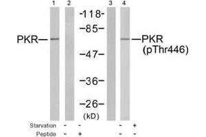 Image no. 2 for anti-Eukaryotic Translation Initiation Factor 2-alpha Kinase 2 (EIF2AK2) (pThr446) antibody (ABIN197048) (EIF2AK2 抗体  (pThr446))