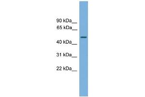 WB Suggested Anti-CPA6 Antibody Titration: 0.