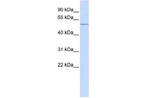 ACVR1C antibody used at 1 ug/ml to detect target protein. (ACVR1C/ALK7 抗体  (N-Term))