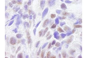 Immunohistochemistry (IHC) image for anti-CREB Binding Protein (CREBBP) (AA 2375-2425) antibody (ABIN7448459)