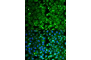 Immunofluorescence analysis of MCF-7 cells using RUNX3 antibody (ABIN4905075). (RUNX3 抗体)