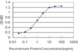 Detection limit for recombinant GST tagged GRM7 is approximately 0. (GRM7 抗体  (AA 431-520))