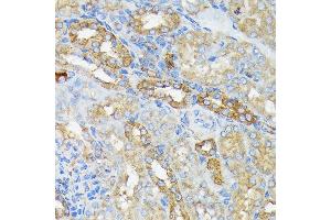 Immunohistochemistry of paraffin-embedded mouse kidney using R Rabbit mAb (ABIN7269840) at dilution of 1:100 (40x lens). (RALBP1 抗体)