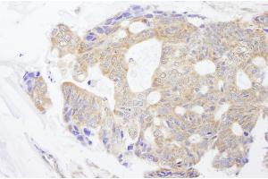 anti-Carbamoyl-Phosphate Synthetase 2, Aspartate Transcarbamylase, and Dihydroorotase (CAD) (AA 1650-1700) antibody