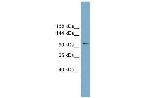 FTSJD1 antibody used at 1 ug/ml to detect target protein. (CMTR2 抗体  (Middle Region))