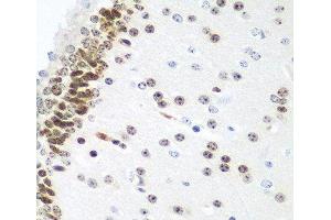 Immunohistochemistry of paraffin-embedded Mouse brain using UBE2U Polyclonal Antibody at dilution of 1:100 (40x lens). (UBE2U 抗体)