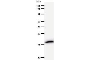 Western Blotting (WB) image for anti-N(alpha)-Acetyltransferase 38, NatC Auxiliary Subunit (NAA38) antibody (ABIN931019) (NAA38 抗体)
