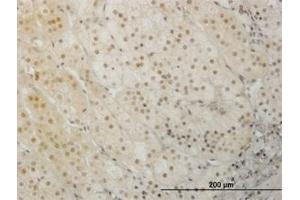 Image no. 3 for anti-LIM Homeobox 1 (LHX1) (AA 1-101) antibody (ABIN598782) (LHX1 抗体  (AA 1-101))