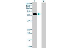 Western Blot analysis of FLVCR1 expression in transfected 293T cell line by FLVCR1 MaxPab polyclonal antibody. (FLVCR 抗体  (AA 1-555))