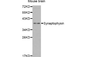 Western blot analysis of extracts of mouse brain, using SYP antibody. (Synaptophysin 抗体)