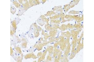 Immunohistochemistry of paraffin-embedded Rat heart using NAT2 Polyclonal Antibody at dilution of 1:100 (40x lens). (NAT2 抗体)