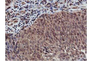 Image no. 2 for anti-V-Akt Murine Thymoma Viral Oncogene Homolog 1 (AKT1) antibody (ABIN1496556) (AKT1 抗体)