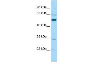 Host:  Rabbit  Target Name:  Creld1  Sample Type:  Mouse Lung lysates  Antibody Dilution:  1.