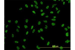 Immunofluorescence of monoclonal antibody to XPO5 on HeLa cell.