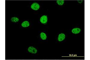 Immunofluorescence of monoclonal antibody to MIPOL1 on HeLa cell. (MIPOL1 抗体  (AA 321-423))