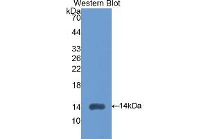 Western blot analysis of the recombinant protein. (LEFTY2 抗体  (AA 245-356))