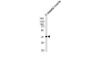 Western blot analysis of lysate from human skeletal muscle tissue lysate, using P1R3B Antibody (C-term) (ABIN1536841 and ABIN2849732). (PPP1R3B 抗体  (C-Term))