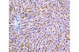 IHC analysis of SLC10A1 using anti-SLC10A1 antibody (ABIN3043337).