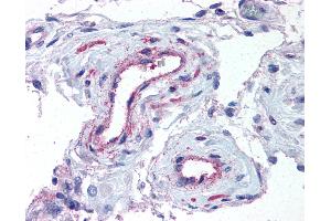 Anti-ADAMTS1 antibody IHC of human testis, vessels. (ADAMTS1 抗体  (N-Term))