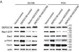 Inhibitor of active Rac1 (NSC23766) reverses the function in DEPDC1B-overexpressing cells. (PAK1 抗体  (AA 1-240))
