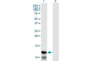 Western Blot analysis of TIMM8A expression in transfected 293T cell line by TIMM8A monoclonal antibody (M01), clone 2F11. (TIMM8A/DDP 抗体  (AA 9-97))
