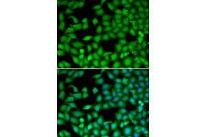 Immunofluorescence analysis of MCF-7 cells using RTKN antibody. (Rhotekin 抗体)