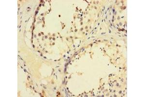Immunohistochemistry of paraffin-embedded human testis tissue using ABIN7176122 at dilution of 1:100 (ZNF165 抗体  (AA 1-485))