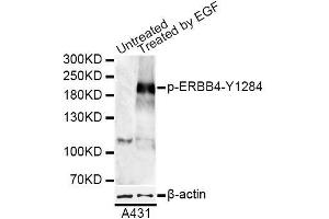 Western blot analysis of extracts of A-431 cells, using Phospho-ERBB4-Y1284 antibody (ABIN5969891) at 1/1000 dilution. (ERBB4 抗体  (pTyr1284))