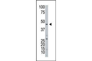Western blot analysis of ART3 Antibody (C-term) in HL60 cell line lysates (25 μg/lane). (ART3 抗体  (C-Term))