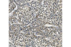 IHC analysis of eRF1/ETF1 using anti-eRF1/ETF1 antibody (ABIN7602626).