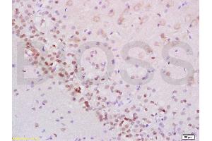 Formalin-fixed and paraffin embedded rat brain labeled with Anti-Phospho-Stat2 (Tyr690) Polyclonal Antibody, Unconjugated (ABIN746183) at 1:200 followed by conjugation to the secondary antibody and DAB staining (STAT2 抗体  (pTyr690))