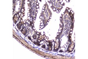 IHC analysis of 14-3-3 zeta/delta using anti-14-3-3 zeta/delta antibody . (14-3-3 zeta 抗体)