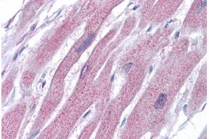 Human Heart: Formalin-Fixed, Paraffin-Embedded (FFPE) (ACTR2 抗体  (AA 40-311))