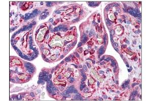 Human Placenta: Formalin-Fixed, Paraffin-Embedded (FFPE) (STAU1/Staufen 抗体  (C-Term))