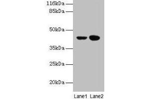 Western blot All lanes: CCR6 antibody at 10 μg/mL Lane 1: MCF-7 whole cell lysate Lane 2: Hela whole cell lysate Secondary Goat polyclonal to rabbit IgG at 1/10000 dilution Predicted band size: 43 kDa Observed band size: 43 kDa (CCR6 抗体  (AA 322-374))