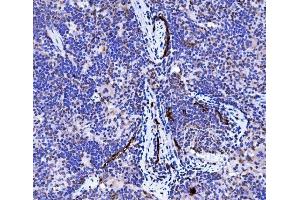 IHC analysis of Podoplanin/gp36/Pdpn using anti-Podoplanin/gp36/Pdpn antibody (ABIN7600811). (Podoplanin 抗体  (AA 24-172))