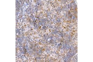 Immunohistochemistry (IHC) image for anti-TNF Receptor-Associated Factor 2 (TRAF2) (AA 1-300) antibody (ABIN3021165)
