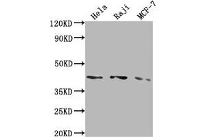 Western Blot Positive WB detected in: Hela whole cell lysate, Raji whole cell lysate, MCF-7 whole cell lysate All lanes: AGTR1 antibody at 1:2000 Secondary Goat polyclonal to rabbit IgG at 1/50000 dilution Predicted band size: 42 kDa Observed band size: 42 kDa (Recombinant Angiotensin II Type-1 Receptor 抗体)