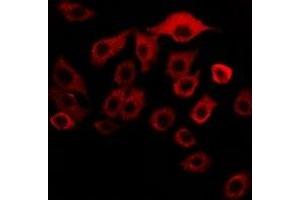 Immunofluorescent analysis of MBTPS1 staining in SKOV3 cells. (MBTPS1 抗体)