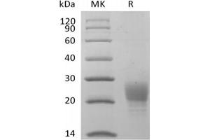 Western Blotting (WB) image for Poliovirus Receptor-Related Immunoglobulin Domain Containing (PVRIG) protein (His tag) (ABIN7321047)